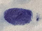 Leucocrystal Violet Presumptive Blood Test