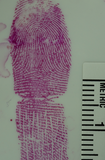 Acid Fuchsin (Hungarian Red)